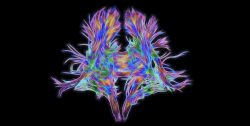 DSI Scan - Emotional Marketing